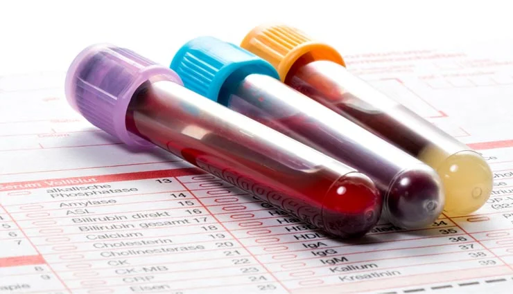 Hemoglobin test and normal amount of hb in blood test
