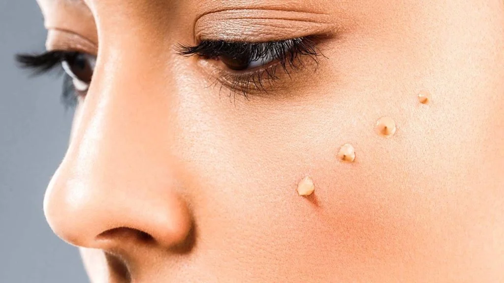 Complications of using moisturizing cream