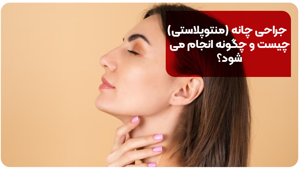 جراحی چانه (منتوپلاستی) چیست و چگونه انجام می‌شود؟