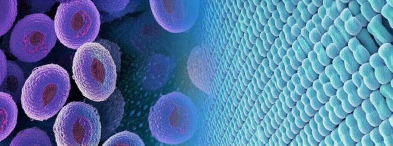 درمان زگیل تناسلی